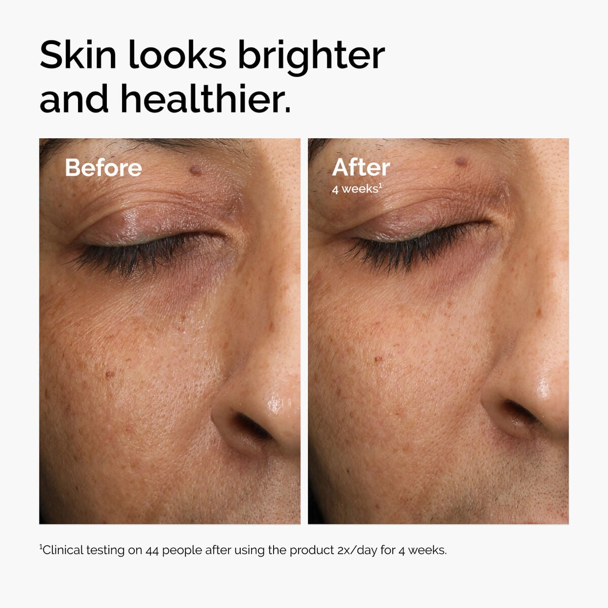 multi-antioxidant-radiance-serum-j6 ord-mars-before-after-healthy.jpg